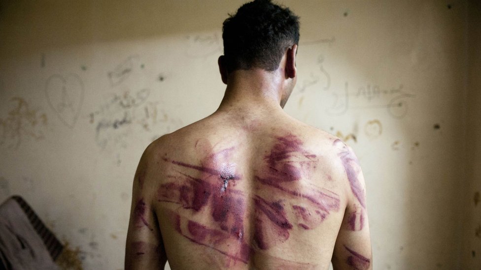 Архивное фото сирийского мужчины со следами пыток на спине (23 августа 2012 г.)