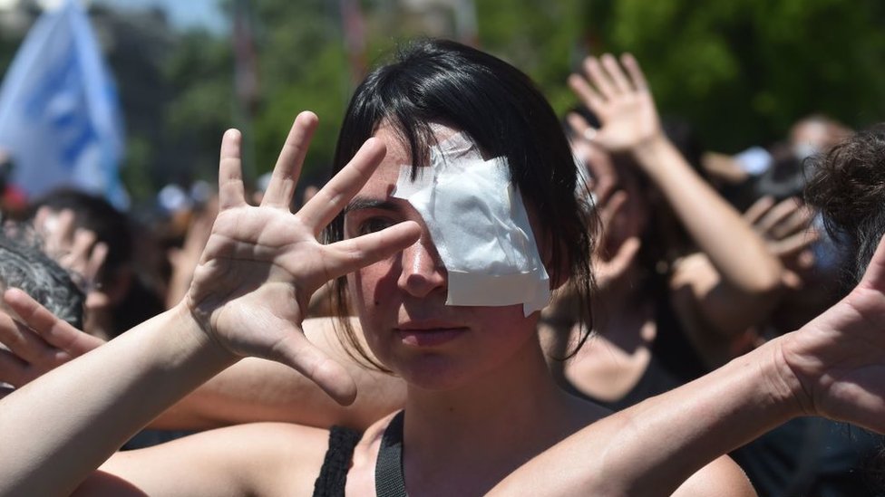 Mujer protestando con un parche en el ojo contra el uso de perdigones.