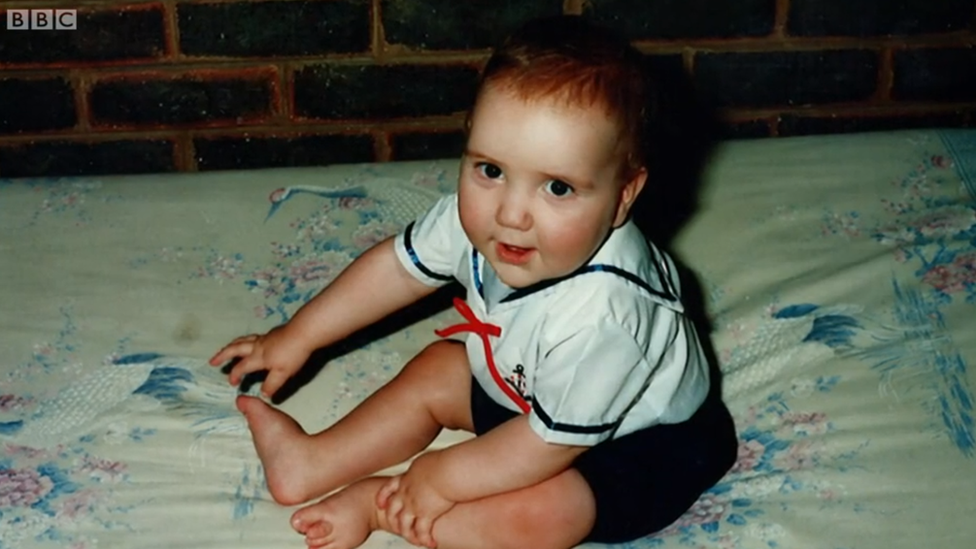 La extraña condición de Tim ayudó a encontrar un tratamiento potencial para una enfermedad mucho más común. Tim de niño