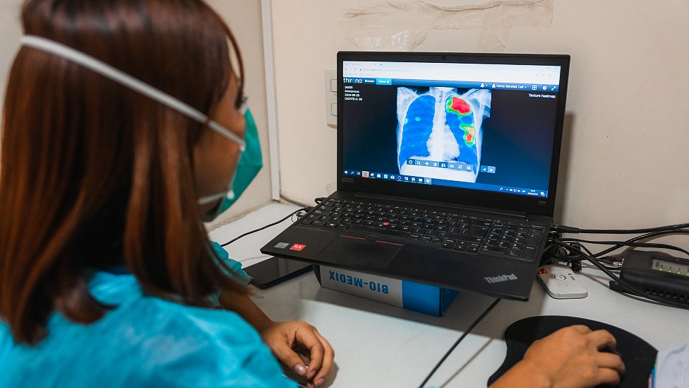 Una trabajadora de la salud examina en la computadora una radiografía en la clínica TB Móvil de Socios en Salud