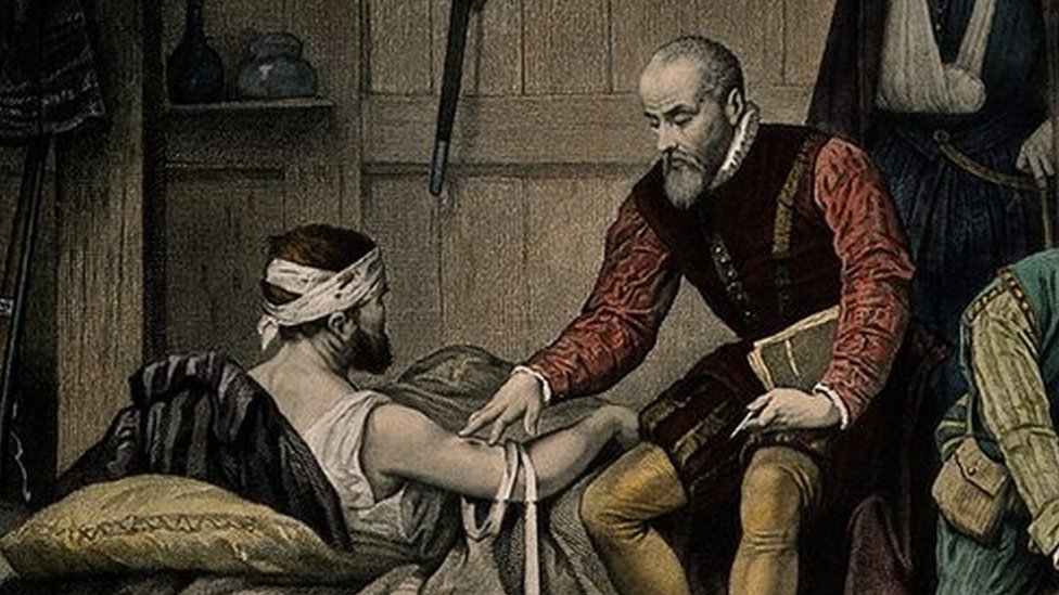 Ambroise Paré, el barbero convertido en médico de los reyes de Francia que  cambió la cirugía para siempre - BBC News Mundo