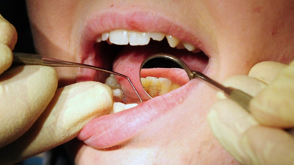 zubar, zubi, popravka zuba, stomatolog