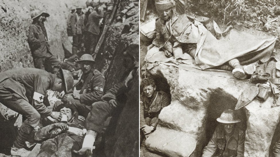 Носильщик на носилках, предлагающий первую помощь; солдаты в окопе, оба во время Первой мировой войны