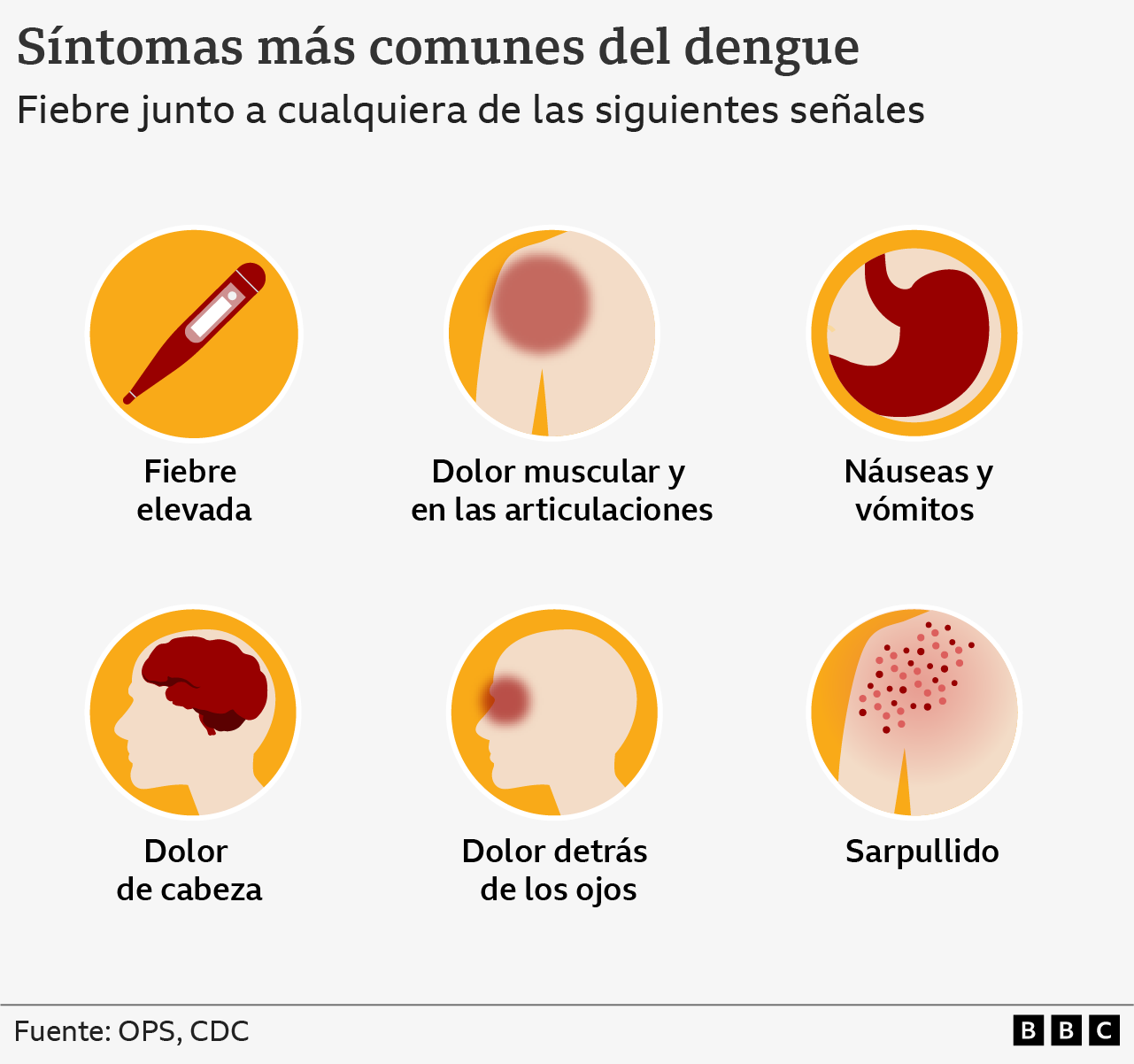 Gráfico con los síntomas del dengue