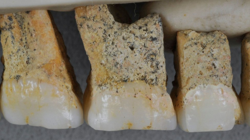 Dientes hallados en Filipinas