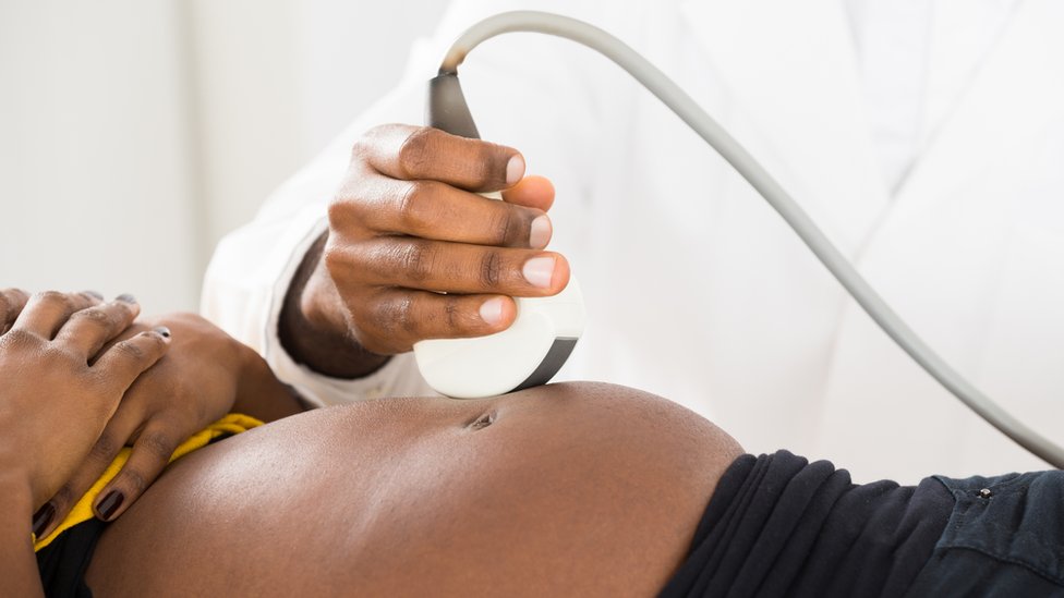 Ultrasound pregnancy scan