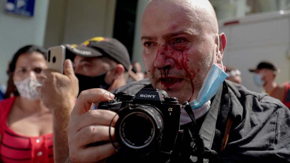 AP haber ajansı için çalışan fotomuhabiri Ramón Espinosa olaylarda yaralandı. >