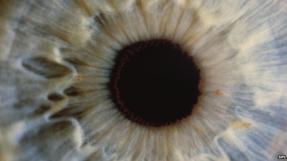 Сток фото - вирусы могут вызывать воспаление в глазу