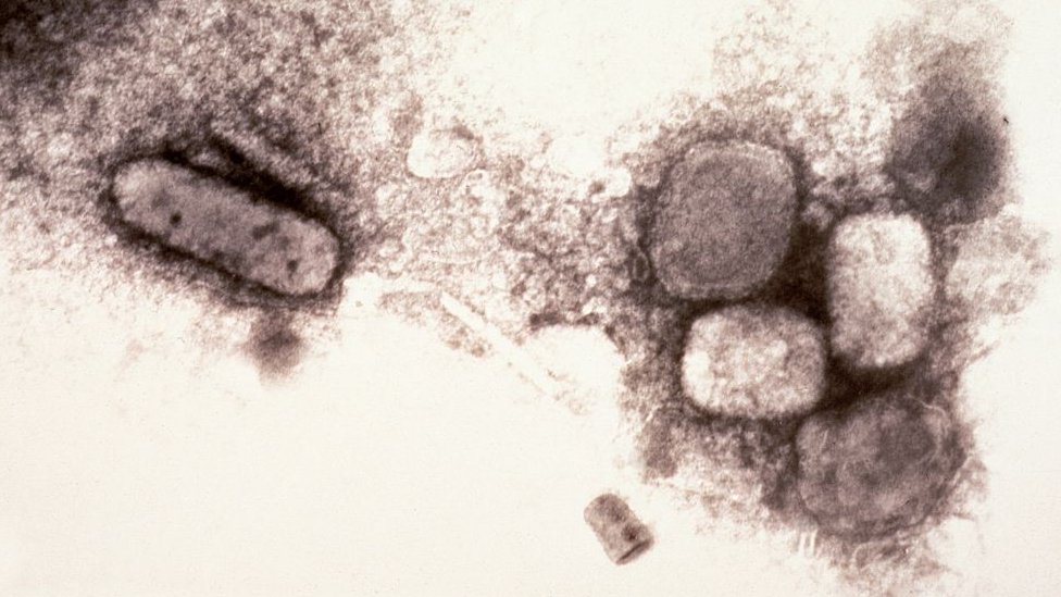 Electron micrograph of the smallpox virus (variola), 1970