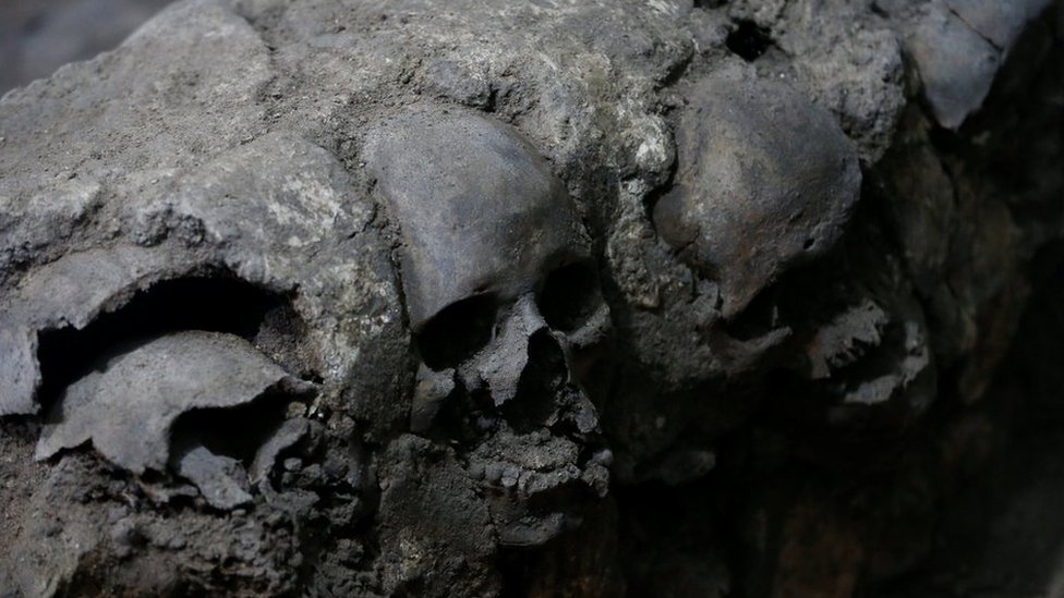 Spanish Conquistador Human Skull with Broad Ax Trauma - Bone