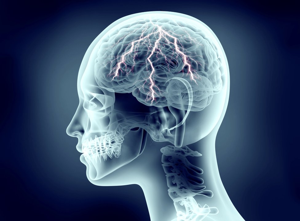 El trastorno del sueño en fase REM puede ser una advertencia temprana de que existe una enfermedad neurológica. Actividad cerebral