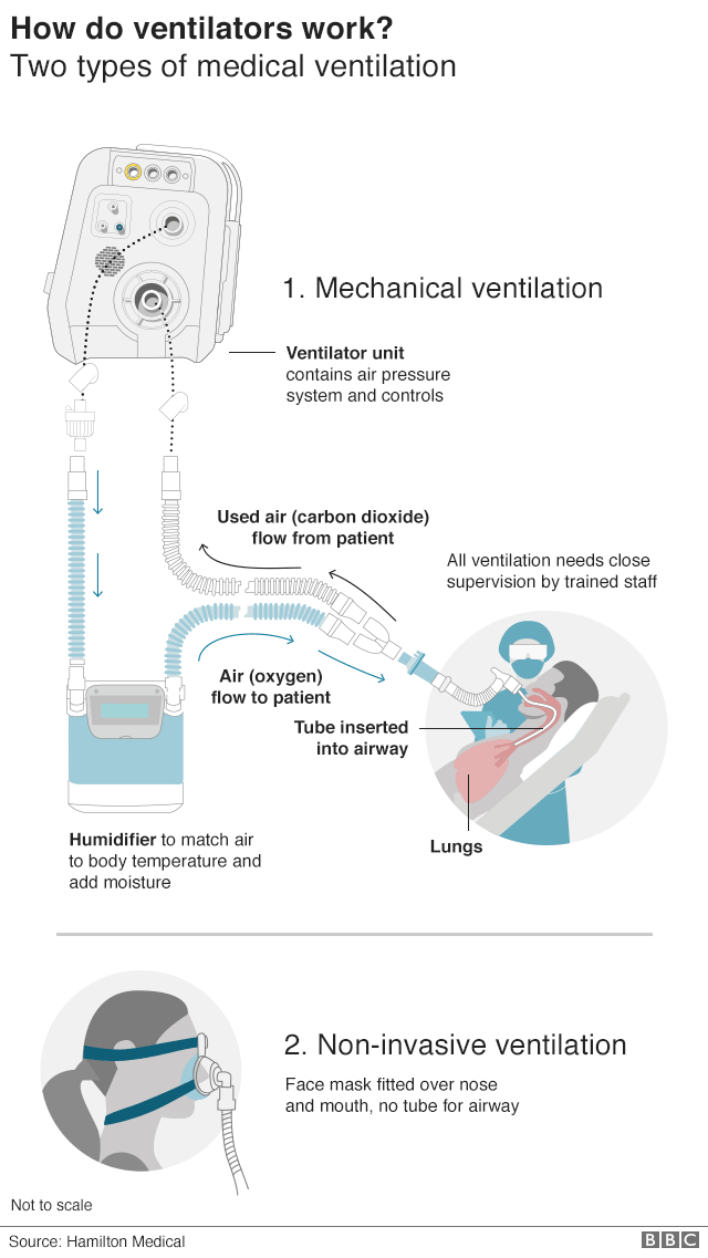График, показывающий два распространенных типа медицинской вентиляции