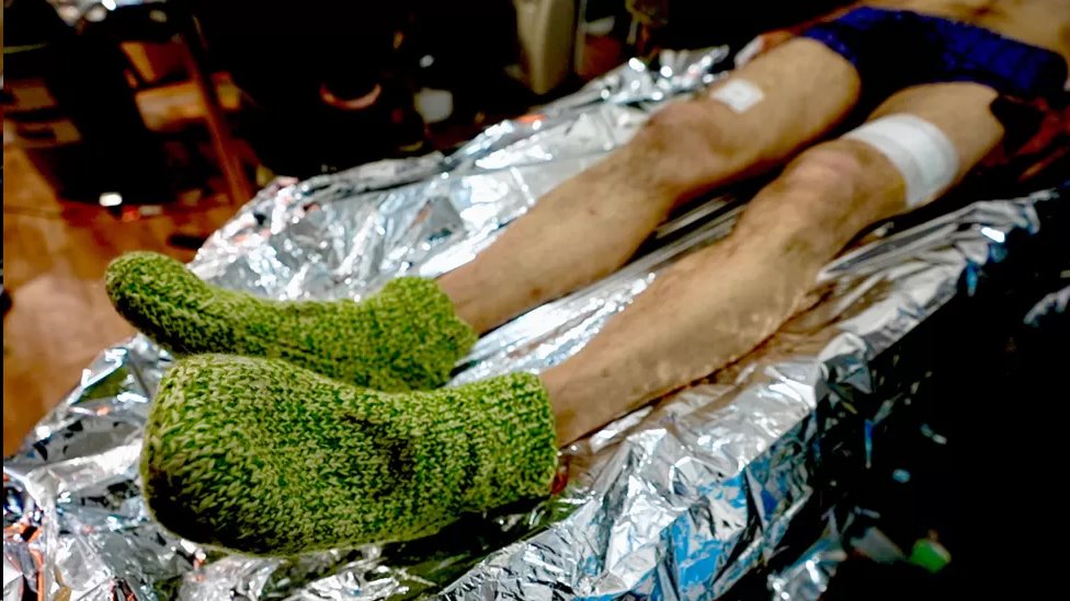 [출처: BBC] 부상당해 야전 병원으로 실려 온 사샤의 발을 우크라이나 국민들이 보내온 털양말이 감싸고 있다