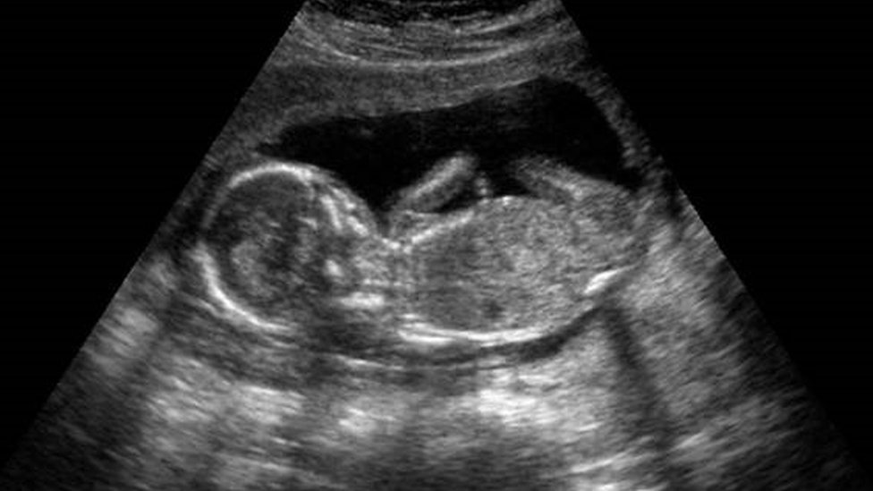 imagem de foto em ultrassom