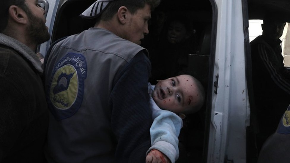 Civilna zaštita pomaže raljenoj bebi u Dumi