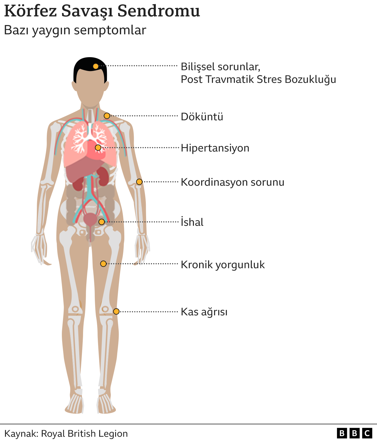 Körfez Savaşı Sendromu