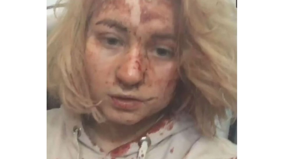 Captura de tela de um vídeo mostrando uma jovem coberta de sangue com ferimentos visíveis no rosto