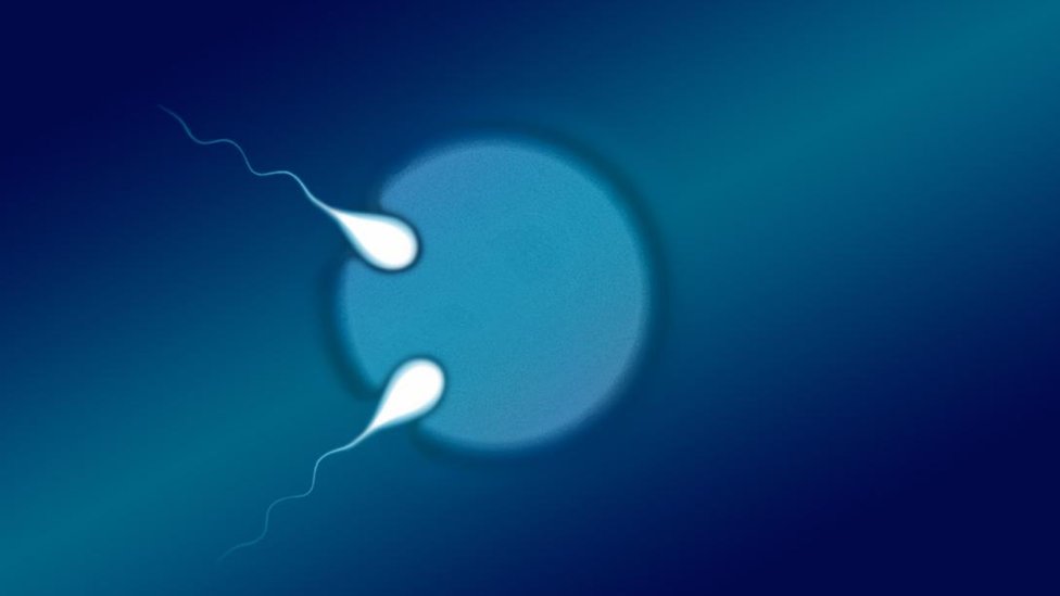 Ilustración de un óvulo fertilizado por dos espermatozoides