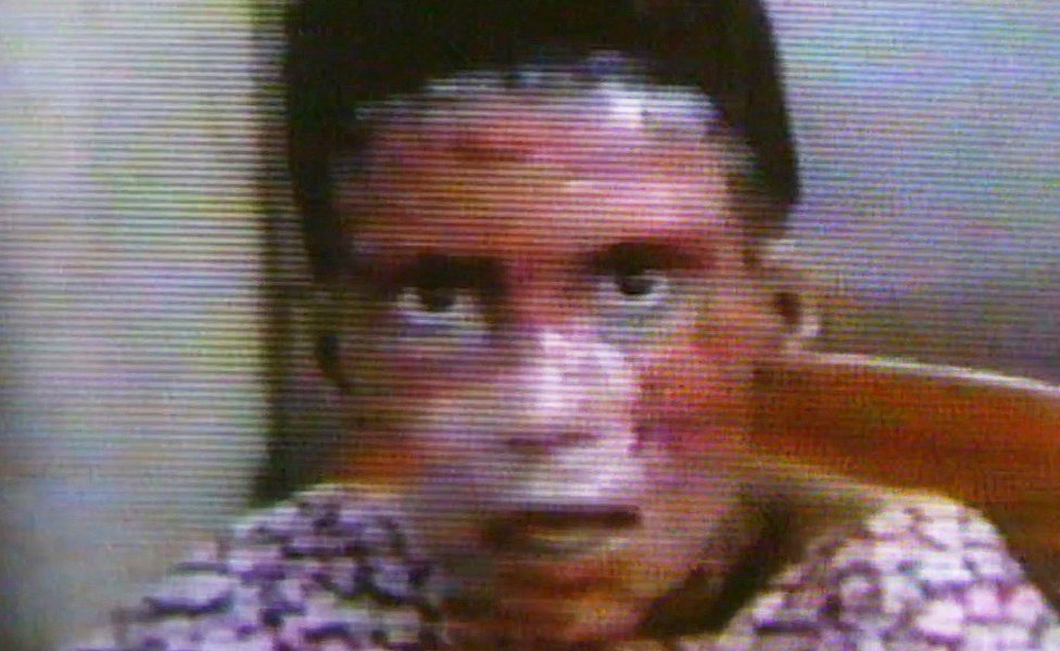 Kanim con el rostro quemado después del ataque en Irak.