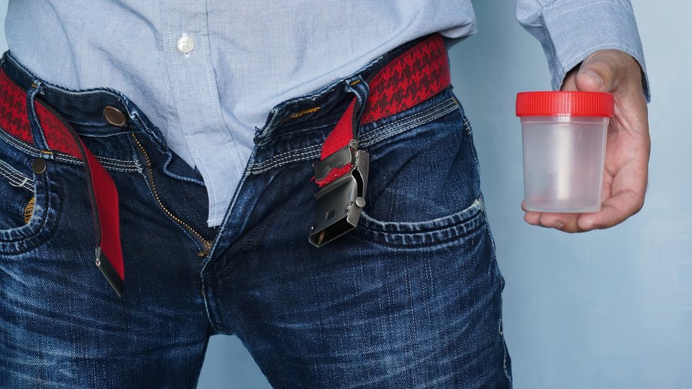 Un análisis de esperma y orina puede detectar la infertilidad. Un hombre con un bote para depositar esperma.