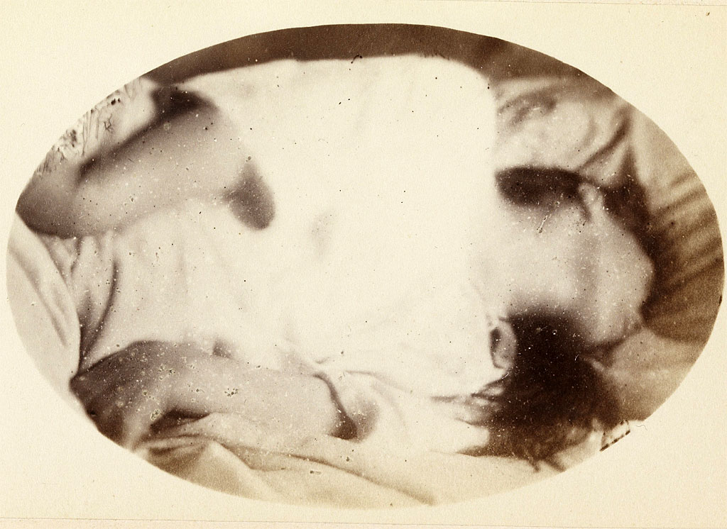 Una de las imágenes de "Iconographie Photographique de la Salpêtrière" identificada como: "Ataque: período epileptídico. Placa XVII".