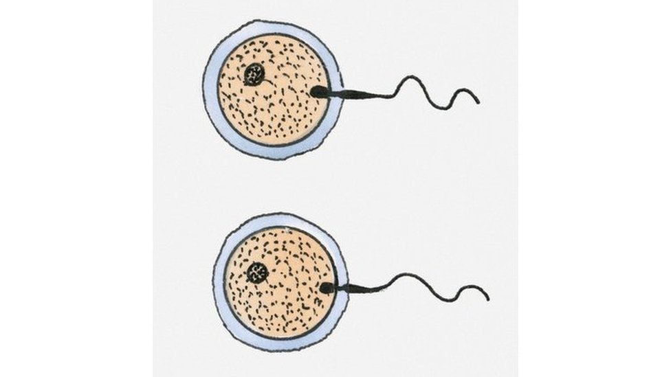 Los mellizos provienen de dos óvulos distintos, pero fecundados al mismo tiempo. Tienen un ADN diferente. Dos óvulos fecundados