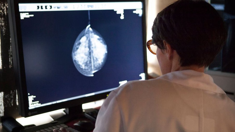 Doctor looking at a medical scan on a screen