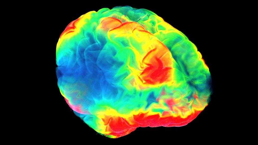 Escáner de un cerebro