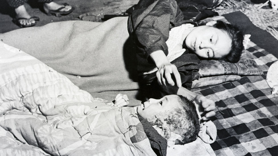 Madre reconfortando a su niño quemado por la bomba de Hiroshima