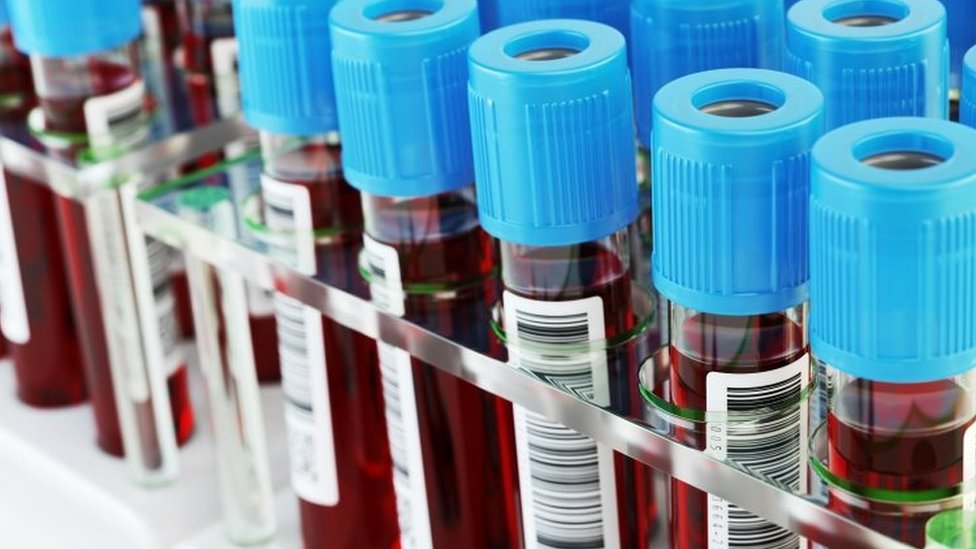Singapore HIV registry data leaked online in health breach