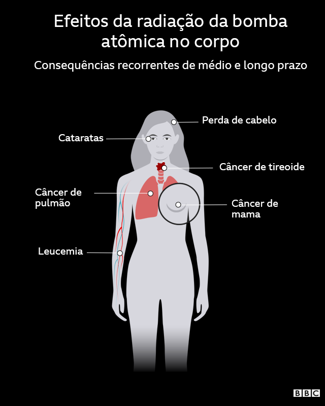 Infográfico