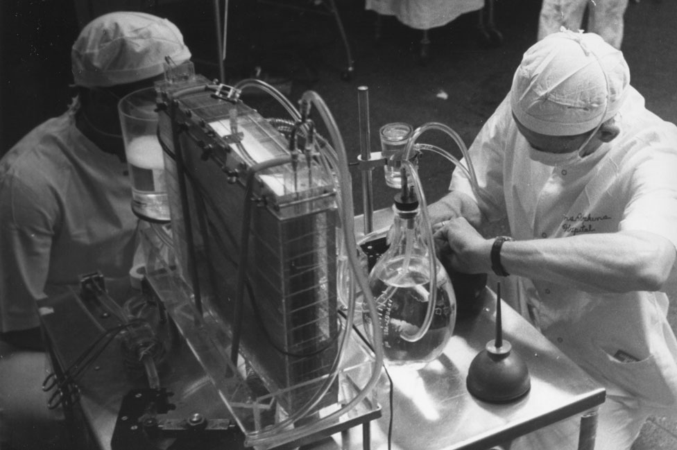 Una máquina de corazón-pulmón en 1959