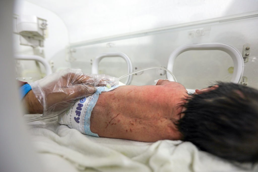 Aya se encuentra en una incubadora en un hospital.