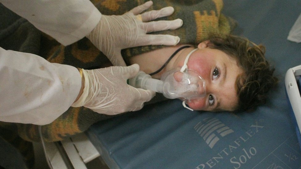 Algunas de las personas lesionadas también tuvieron vómitos y les salió espuma de la boca, lo que ha llevado a decir que se usó un agente químico. Un niño recibe atención médica