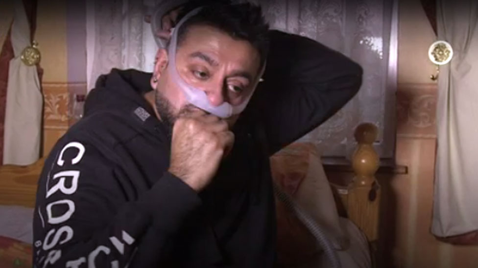 Mohammed utiliza una máquina y mascarilla para ayudarle a respirar mientras duerme. Mohammed Dhanji