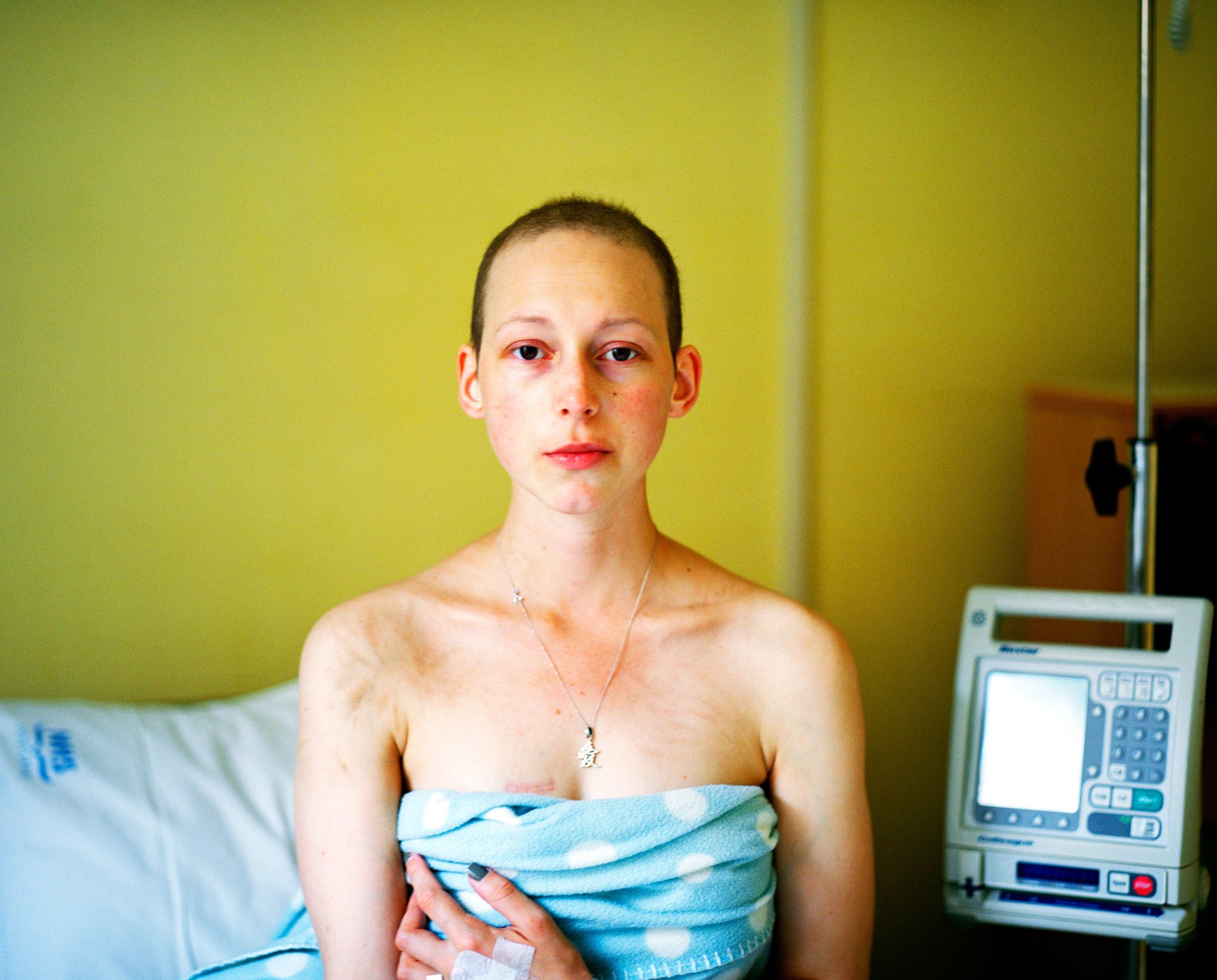 Kemoterapinin Son Günü adlı fotoğrafı, 2018 Britanya Portre Ödülleri'nde finale kaldı