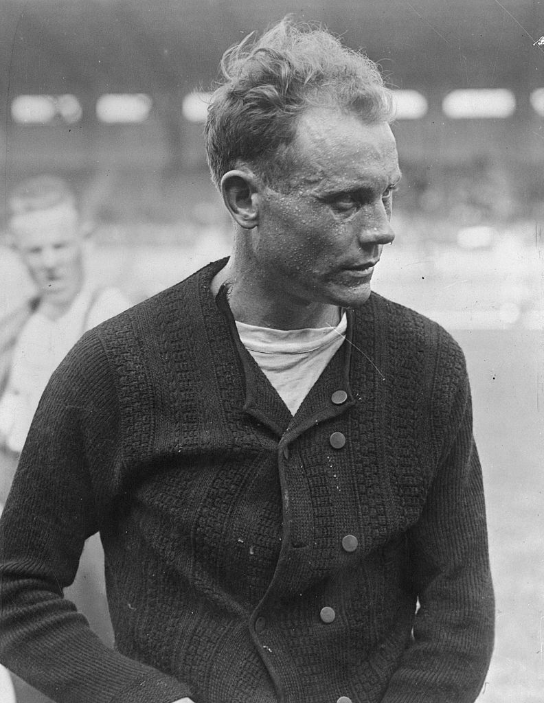 Nurmi je pre Pariza već osvojio tri zlatne olimpijske medalje u Antverpenu 1920. godine