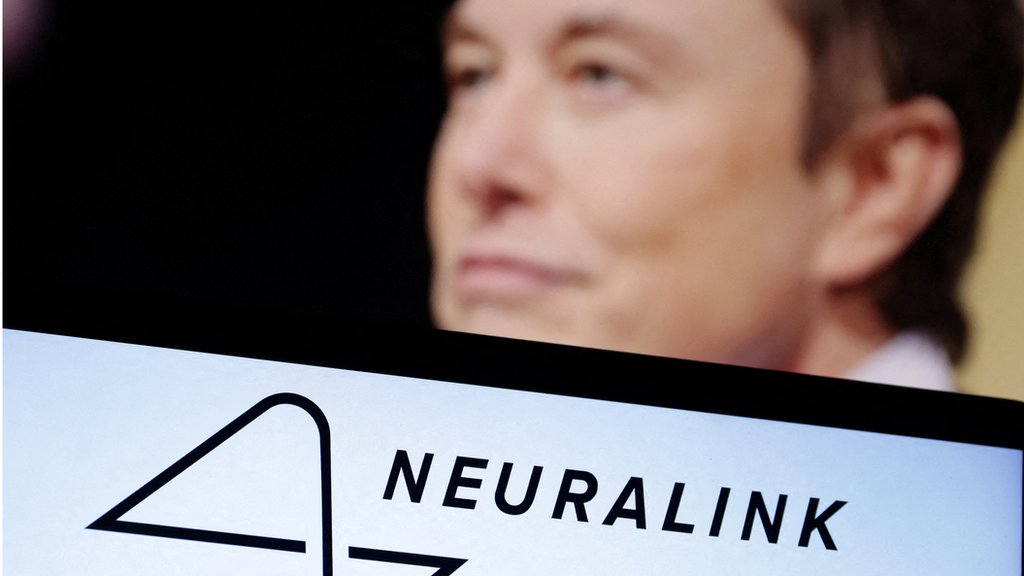 Elon Musk Details Neuralink Brain Interface Tech, Oculus CTO Calls