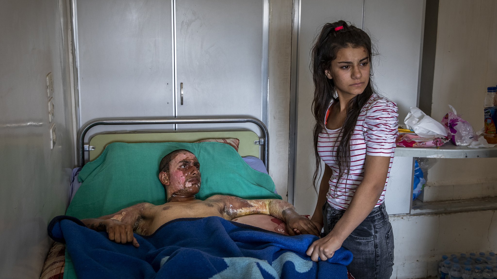 Раненый курдский боец ??посещает больницу