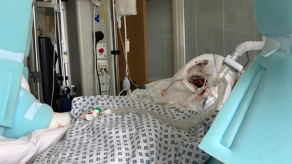 Крис Уильямс-Эллис был в искусственной коме в больнице