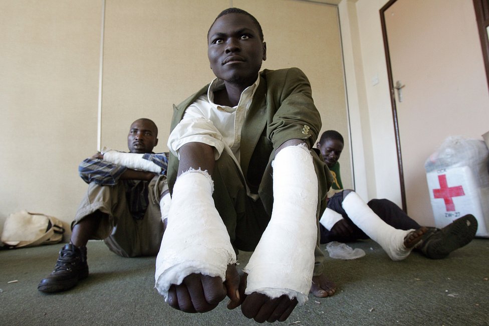 Трое членов Движения за демократические перемены (ДДП), которые говорят, что их избили палками представители молодежи Мугабе в Масвинго, в 300 км к югу от Хараре, позируют 3 мая 2008 года в Хараре.