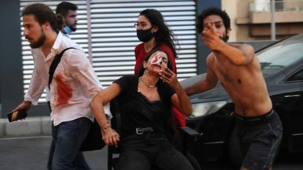 Ledakan hebat di Beirut
