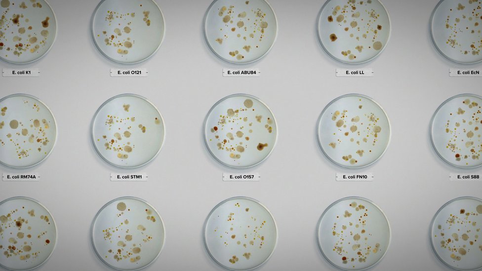 Dishes containing various types of E. coli bacteria