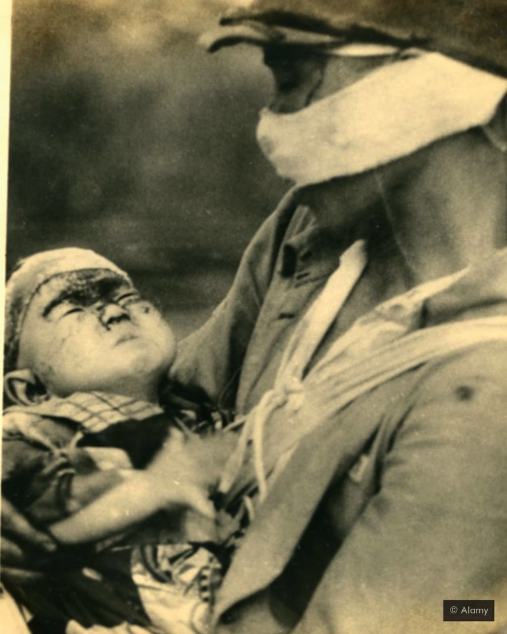 Ranjeno dete u Hirošimi