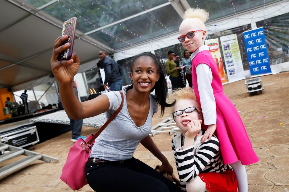 takmičenje za mis albino u keniji