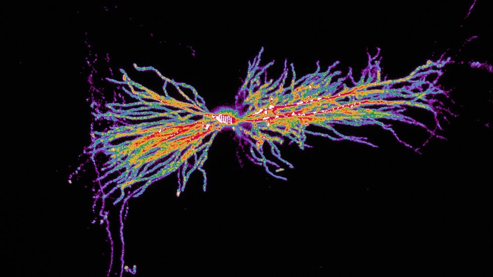 Una interneurona en el hipocampo coloreada con computador por Biosciences Imaging Gp, Soton