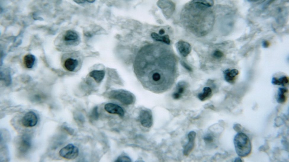 صورة مجهرية للنيجلرية الدجاجية