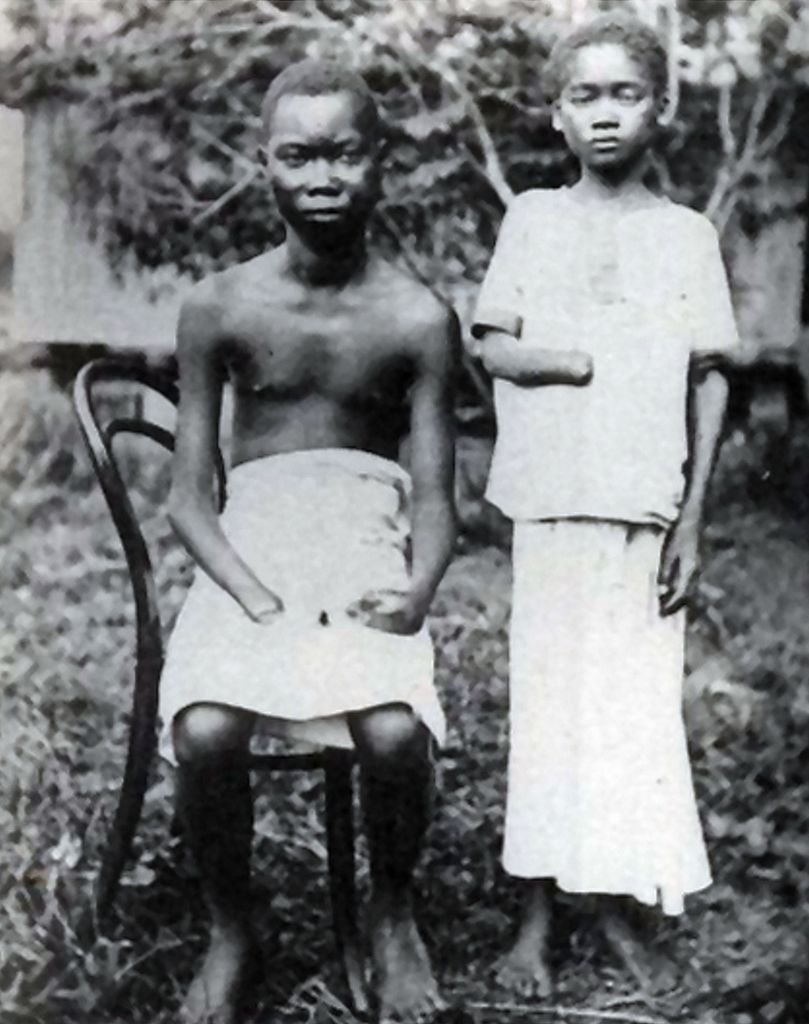 كنوع من العقاب، كان المستعمرون يقومون ببتر وتشوية أطراف الكونغوليين بما ما في ذلك الأطفال.