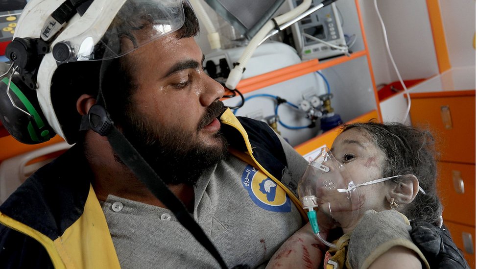 One of the white helmets provides medical badistance to an infected Syrian child