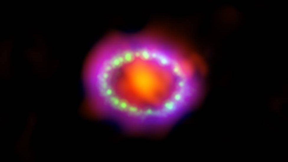 Picture of supernova 1987a